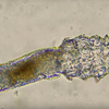 face mites