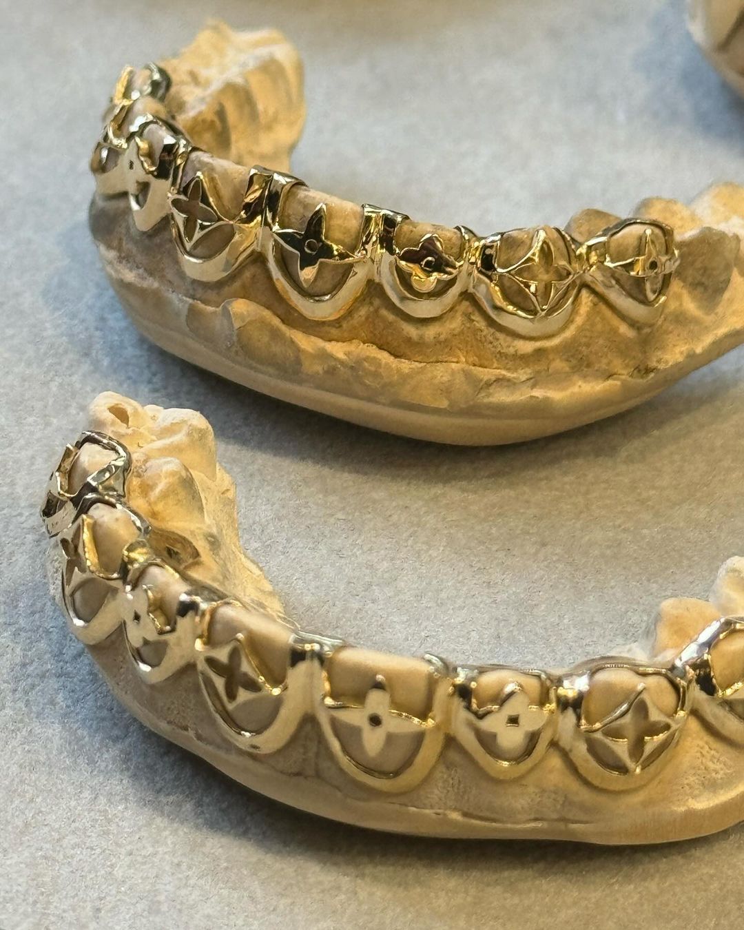 Les grillz de Dolly Cohen pour Louis Vuitton