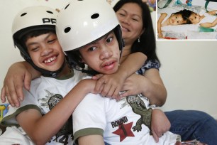 Formerly conjoined twins Clarence, left, and Carl Aguirre, are embraced by their mother at the family's home in Scarsdale, N.Y. in July.