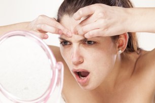 The (Lack Of) Science Behind Acne Treatments