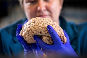 Donna Wilcock, of the Sanders-Brown Center on Aging, holds a brain in her lab in Lexington, Ky.