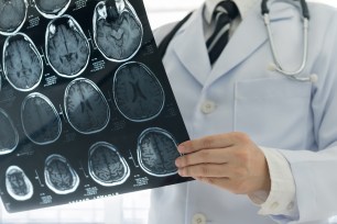 Doctor looks at an X-ray of a brain.