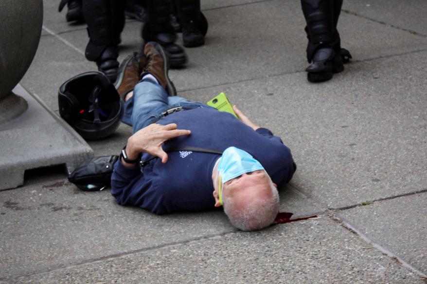 Martin Gugino lays on the ground after he was shoved by two Buffalo police officers.