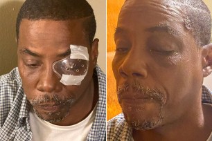 Kenneth Bacote, who was allegedly tased in the eye by cops in Brooklyn last week.