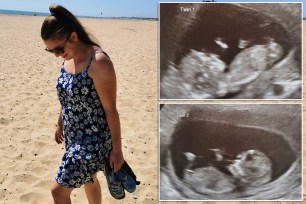 Kelly Fairhurst discovered she was expecting twins during a scan, and that each twin was developing in a separate womb.
