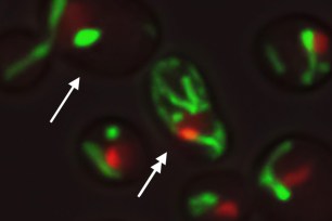 Yeast cells with the same DNA under the same environment show different structures of mitochondria (green) and the nucleolus (red), which may underlie the causes of different aging paths.