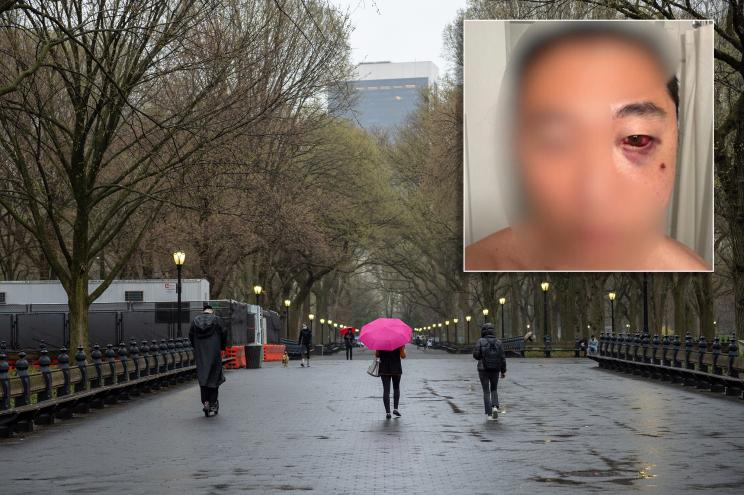 A 38-year-old Asian man walking with his wife and 5-year-old son was sucker-punched in Central Park on Saturday.