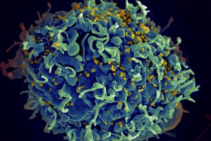 This electron microscope image made available by the US National Institutes of Health shows a human T cell, in blue, under attack by HIV, in yellow, the virus that causes AIDS.