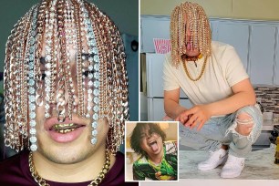 Meet Dan Sur, the 23-year-old Mexican goldilocks who claims he's the "first rapper ... in human history" to rock an assortment of gold chains as "hair" hanging from hooks he surgically implanted into his scalp.