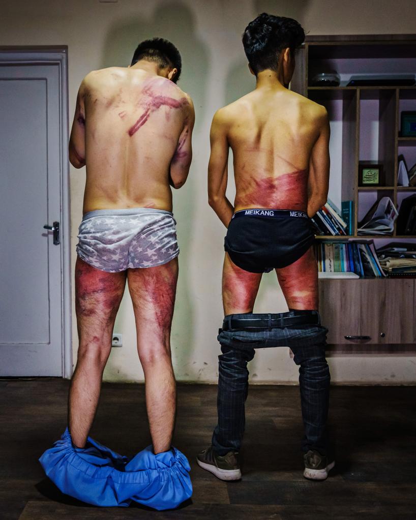 On September 8, 2021 journalists Nemat Naqdi (left) and Taqi Daryabi were tortured and beaten by Taliban fighters for reporting on women's rights.