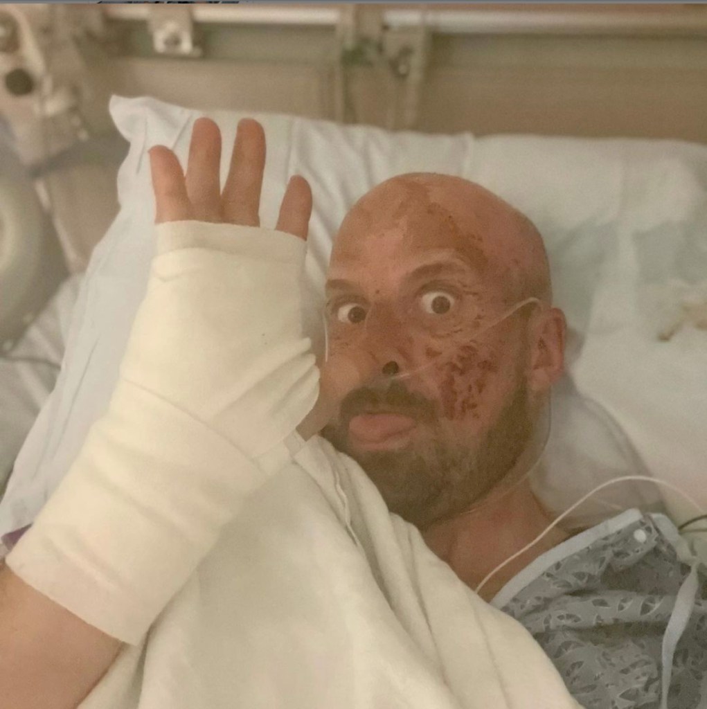 Injured stuntman in his hospital bed wrapped in gauze waves to the camera and makes a cheeky face. 