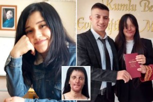 Berfin Ozek, 20, tied the knot with Casim Ozan Celtik, 23, this month — just two years after doused her with acid during an argument. Ozek is pictured at left prior to the attack.