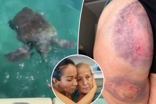 A Russian swimmer was bitten on the butt, nearly drowned by an angry sea turtle.