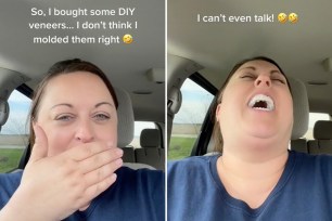 The mom shared her veneer mishap to TikTok.