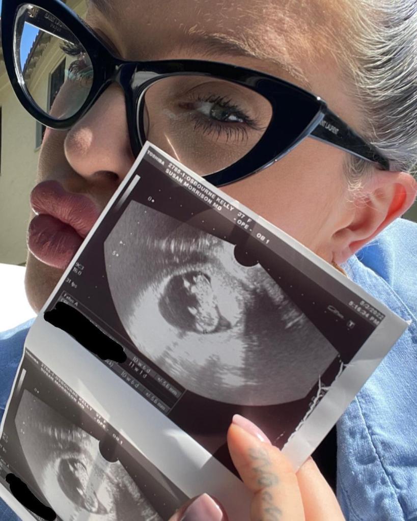 Kelly Osbourne holding a sonogram. 