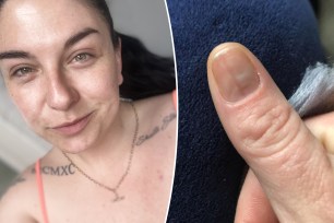 Stacey Boss, 32, said she had shrugged off the mark on her right thumbnail for a while, until her nail tech discovered it in November 2019 and refused her a manicure, urging her to go to the doctor instead.