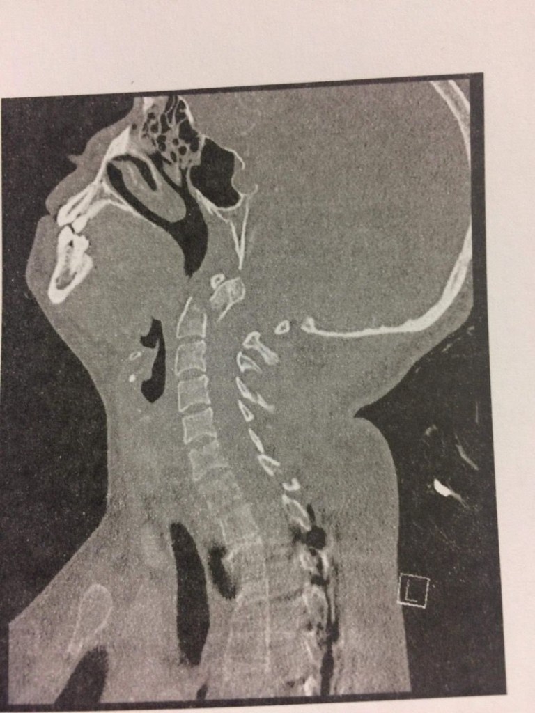 Some sort of scan of a head, neck and spine