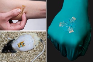 image of a stretchable bandage with electronics