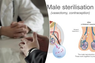 The number of men undergoing vasectomies has increased dramatically in recent years, based on health insurance claims.