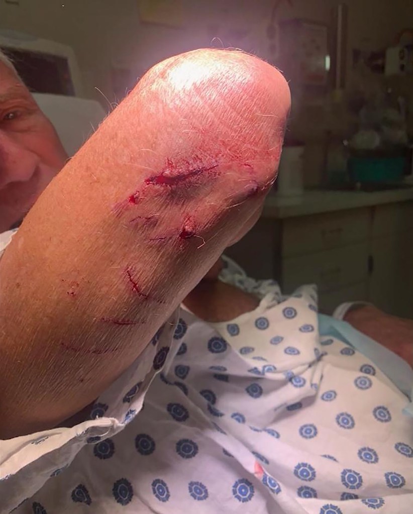Bloody wounds seen on Matt Leffers' arm