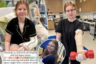 Kennedy, 14, suffered third-degree burns on her arm while removing her nails near a lit candle.