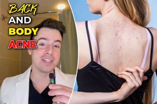 NYC dermatologist Dr. Charles Puza is sharing three ways to get rid of back acne, also known as "bacne" — eliminate bacteria, use a benzoyl peroxide wash, and change workout clothes often.