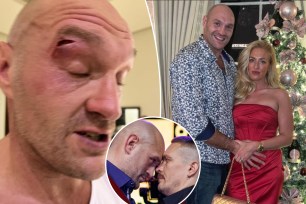 Tyson Fury suffered a cut during sparring.