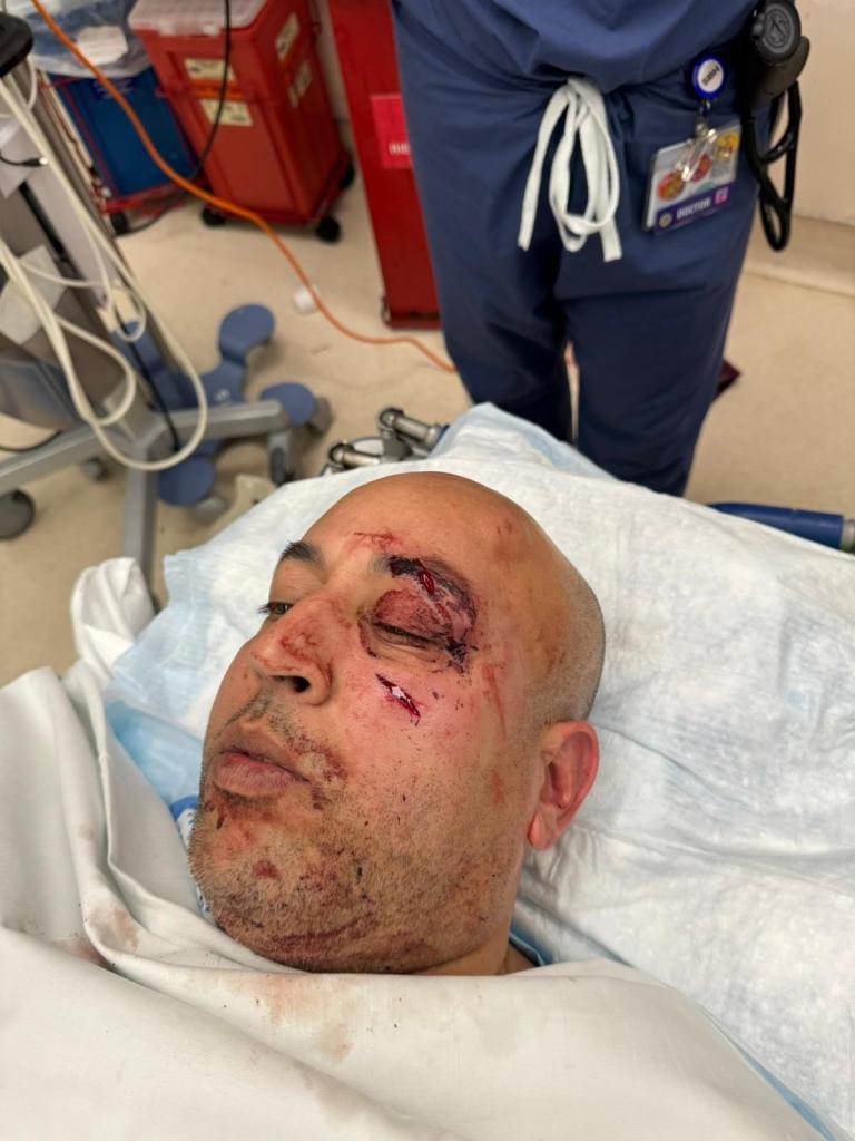 A photo of NYPD Lt. Gypsy Pichardo, who was pummeled by two thugs in the Bronx in November.