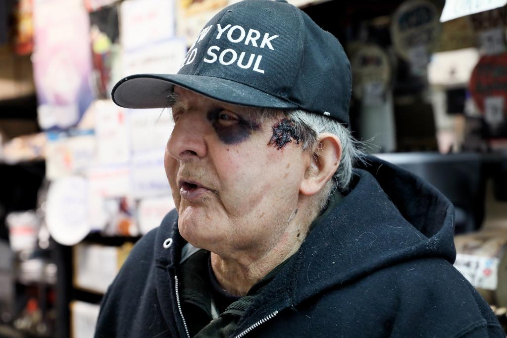 Ray Alvarez, the owner of Ray's Candy Store, was bloodied with a black eye after the attack.