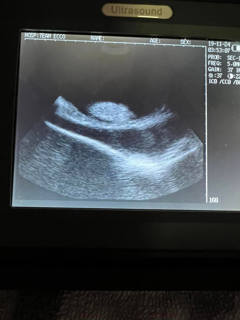 An ultrasound showing a pregnant stingray