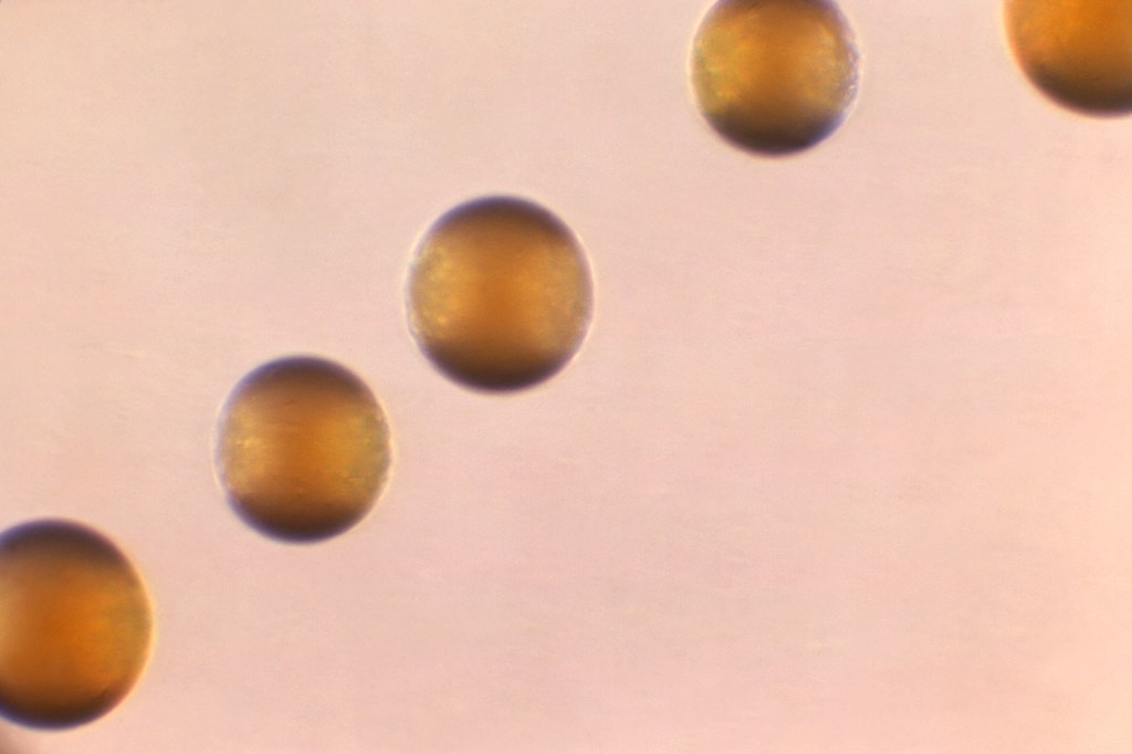 1966 microscope image of Group-B Neisseria meningitidis bacteria colonies related to surge in invasive meningococcal disease reported by CDC in 2024