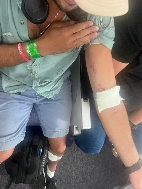 A passenger shows his injuries after an incident on a LATAM Airlines Boeing 787, in Auckland, New Zealand, March 11, 2024.