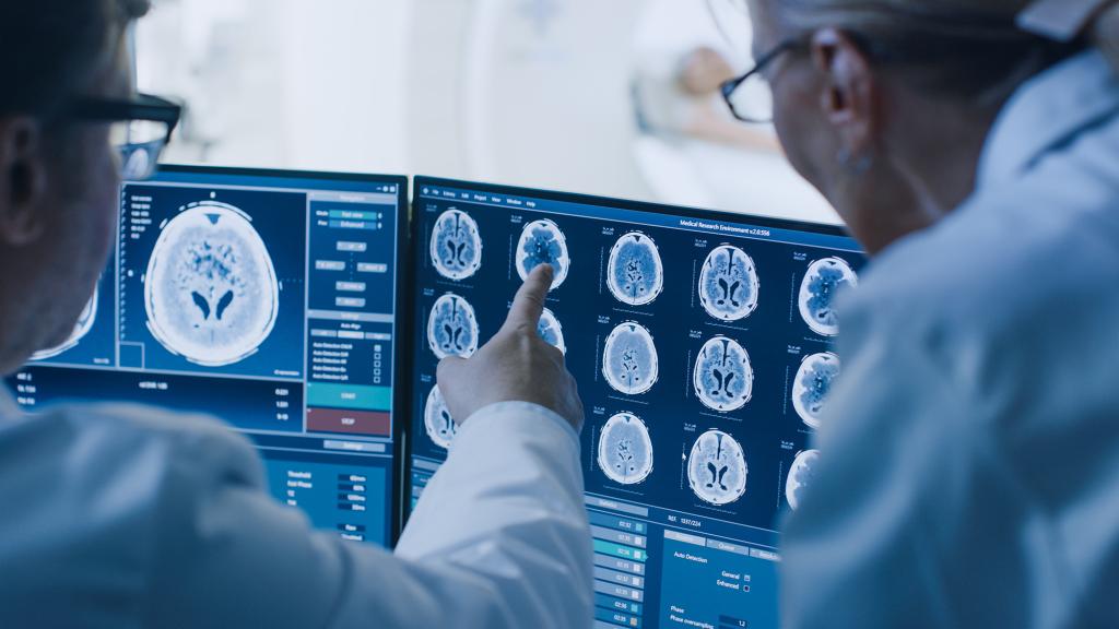 Radiologist and doctor discuss brain scans 