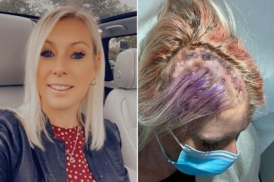 Kirsty Connell, 39, went to her doctor after suffering terrible headaches and frequent feelings of déjà vu. She was diagnosed with a grade 2 oligodendroglioma.