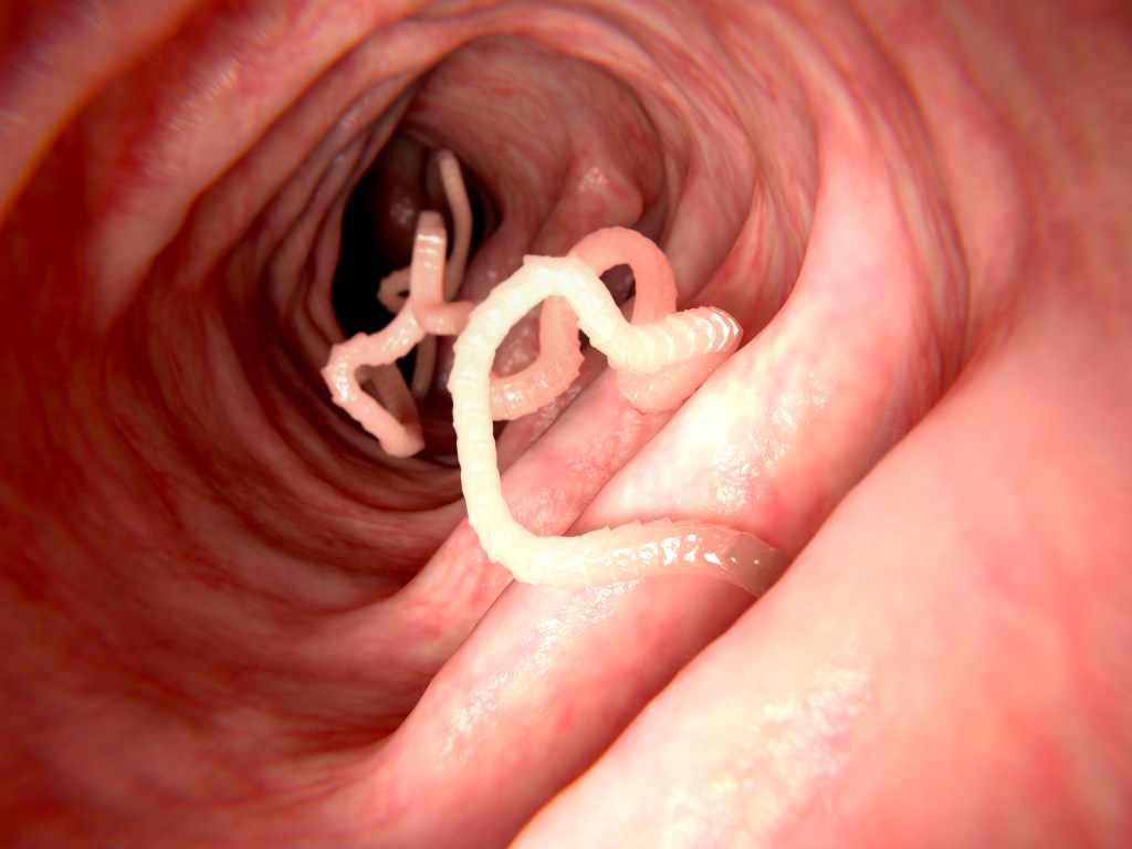 A man's brain tapeworm from bad bacon is the focus of a new medical study.