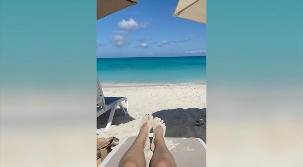 Suyapa Ramos sitting on a beach chair with scars and bruises from her trip to Turks and Caicos