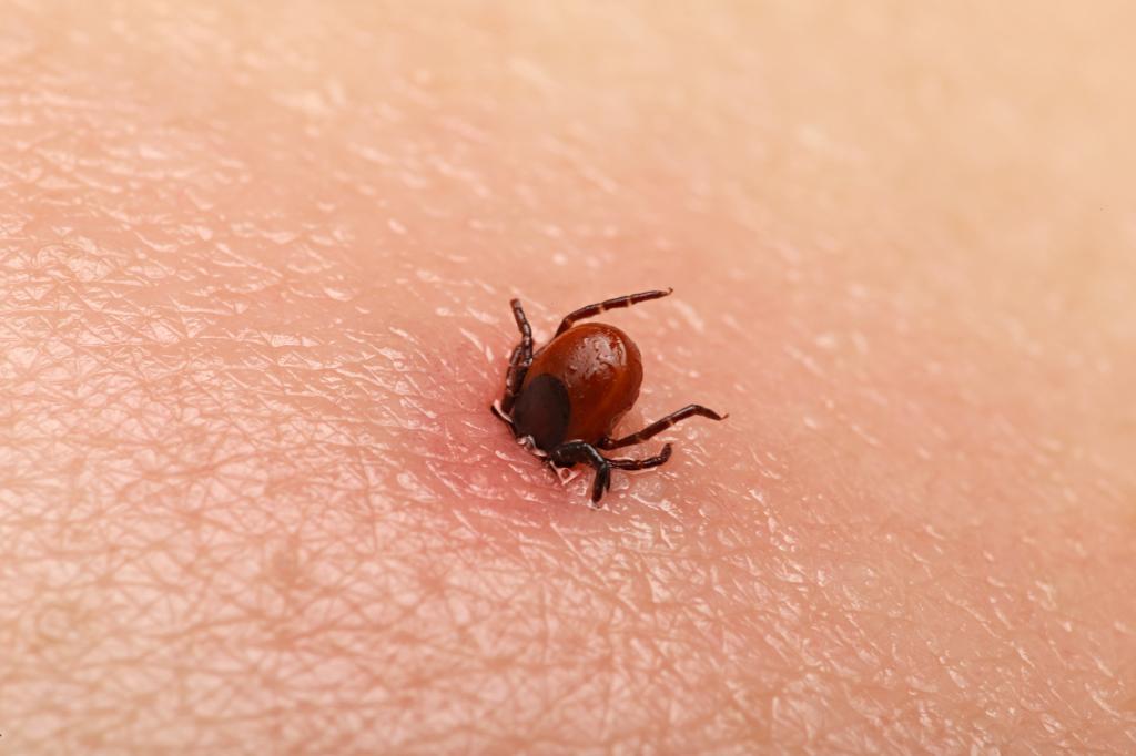 Encephalitis tick  Ticks on human skin. Ixodes ricinus can transmit both bacterial and viral pathogens such as the causative agents of Lyme disease and tick-borne encephalitis.