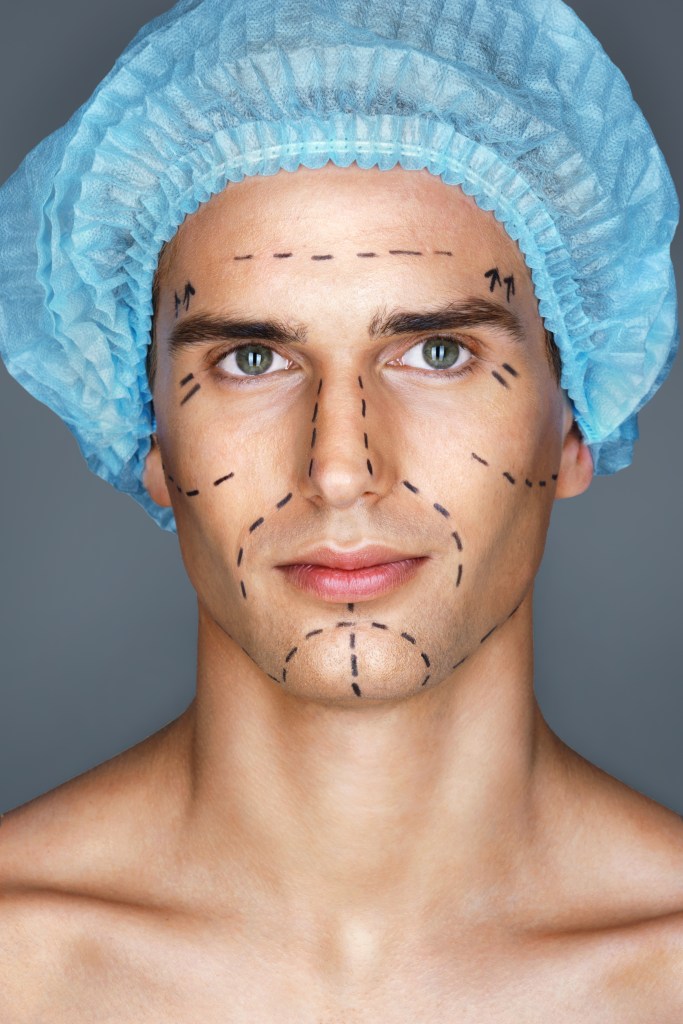 A handsome man with pencil marks on his face, ready for cosmetic surgery. Medical hat, aesthetic cosmetology concept.