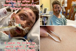 A Texas man miraculously survived a complicated medical ordeal — beating the 4% odds doctors reportedly gave him. He developed sepsis after attempting to remove an ingrown hair.