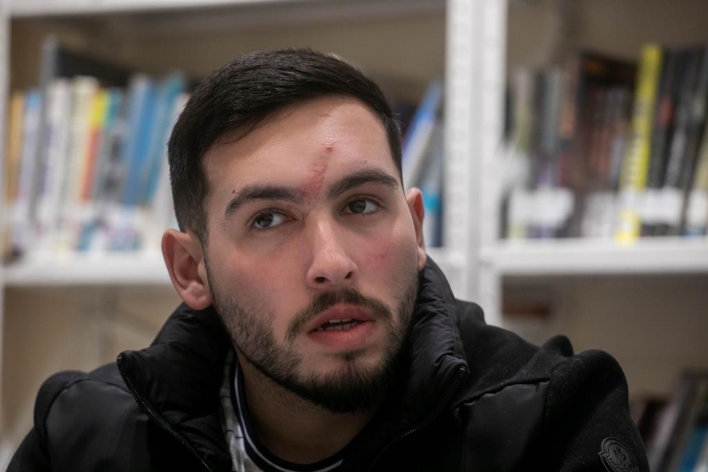 Or Kakiashvili, with shrapnel scar on his forehead between his eyes