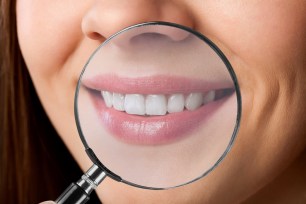 Close-up image of a woman's white teeth being examined by a magnifying glass.