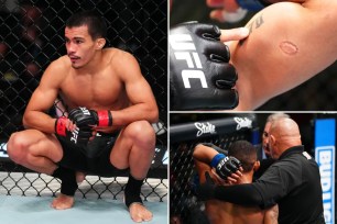 Igor Severino was disqualified and soon after released by UFC after biting Andre Lima (top and bottom insets) during their UFC Fight night bout.