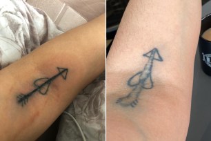 before and after "hairy penis" tattoo