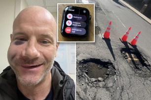 New York real estate broker Eric Zollinger claims his Apple Watch saved his life by dialing 911 following a horrific bike accident that left him looking like a "monster."