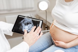 doctor with an ultrasound scan of unborn child