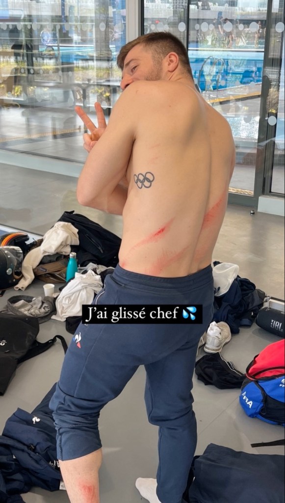 Photo shows scrapes on Alexis Jandard's back after the fall 