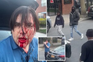 The driver with his face covered in blood, the young attempted robbers and his vehicle in Flatbush, Brooklyn.