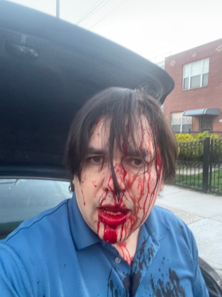 Juan Alfredo covered in his blood.