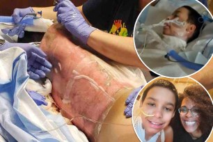 Arizona mother Tiffany Roper is warning about the dangers of social media after her preteen son Corey suffered burns all over his body during a "TikTok challenge" gone awry.