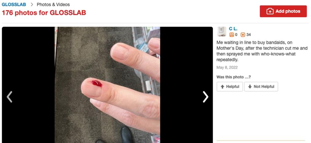 Close up of a finger with a blood drop, representing poor manicure service reviewed on Yelp for Glosslab nail salon chain